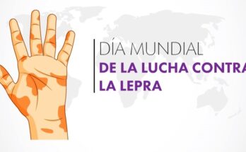 En Florida acciones educativas por el Día Mundial de Lucha contra la Lepra