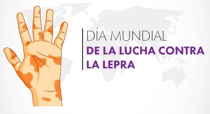 En Florida acciones educativas por el Día Mundial de Lucha contra la Lepra