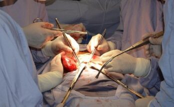 Más de mil trasplantes de órganos se realizan cada año en Vietnam